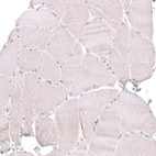 Immunohistochemical staining of human skeletal muscle shows negative to very weak cytoplasmic positivity in myocytes.