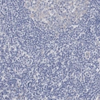 Immunohistochemical staining of human tonsil shows no positivity in non-germinal center cells as expected.