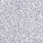 Immunohistochemical staining of human liver shows no positivity in hepatocytes as expected.