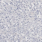Immunohistochemical staining of human liver shows no positivity in hepatocytes as expected.