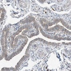 Immunohistochemical staining of human fallopian tube shows moderate cytoplasmic positivity in glandular cells.