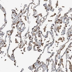 Immunohistochemical staining of human lung shows strong cytoplasmic positivity in alveolar cells.