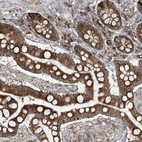 Immunohistochemical staining of human small intestine shows strong cytoplasmic positivity in glandular cells.