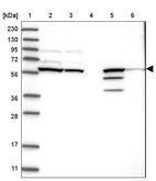 Lane 1: Marker [kDa] 230, 130, 95, 72, 56, 36, 28, 17, 11_br/_Lane 2: Human cell line RT-4_br/_Lane 3: Human cell line U-251MG sp_br/_Lane 4: Human plasma (IgG/HSA depleted)_br/_Lane 5: Human liver tissue_br/_Lane 6: Human tonsil tissue