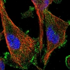 Immunofluorescent staining of human cell line U-251 MG shows localization to plasma membrane.