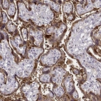 Immunohistochemical staining of human placenta shows strong cytoplasmic positivity in trophoblastic cells.