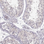 Immunohistochemical staining of human testis shows no cytoplasmic positivity in cells in seminiferous ducts as expected.