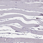 Immunohistochemical staining of human skeletal muscle shows no positivity in myocytes as expected.