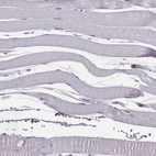 Immunohistochemical staining of human skeletal muscle shows no positivity in myocytes as expected.