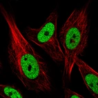Immunofluorescence staining in U251 cell line with Anti-HNRNPC monoclonal antibody, showing distinct nuclear (without nucleoli) staining in green. Microtubule- and nuclear probes are visualized in red and blue respectively (where available).