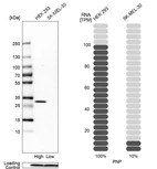 Western blot analysis in human cell lines HEK293 and SK-MEL-30 using Anti-PNP antibody. Corresponding PNP RNA-seq data are presented for the same cell lines. Loading control: Anti-PFN1.