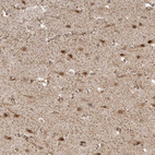 Immunohistochemical staining of human cerebral cortex shows strong nuclear and cytoplasmic positivity in neurons.
