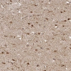 Immunohistochemical staining of human cerebral cortex shows strong nuclear and cytoplasmic positivity in neurons.