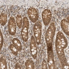 Immunohistochemical staining of human duodenum shows strong nuclear and cytoplasmic positivity in glandular cells.
