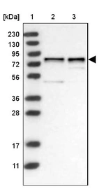 Lane 1: Marker [kDa] 230, 130, 95, 72, 56, 36, 28, 17, 11_br/_Lane 2: Human cell line RT-4_br/_Lane 3: Human cell line U-251MG sp