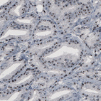 Anti-NOP56 Antibody