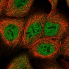 Immunofluorescent staining of human cell line A-431 shows localization to nucleoplasm & cytosol.