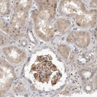 Immunohistochemical staining of human kidney shows strong membranous positivity in cells in glomeruli.