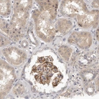 Immunohistochemical staining of human kidney shows strong membranous positivity in cells in glomeruli.