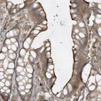 Immunohistochemical staining of human colon shows moderate cytoplasmic positivity in glandular cells.
