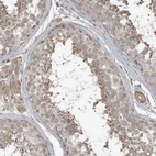 Immunohistochemical staining of human testis shows moderate cytoplasmic positivity in cells in seminiferous ducts.