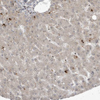 Immunohistochemical staining of human liver shows negative to very weak cytoplasmic positivity in hepatocytes as expected.