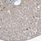 Immunohistochemical staining of human liver shows negative to very weak cytoplasmic positivity in hepatocytes as expected.