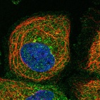 Immunofluorescent staining of human cell line A-431 shows localization to plasma membrane.