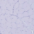 Immunohistochemical staining of human skeletal muscle shows no positivity in myocytes as expected.
