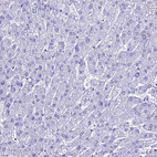 Immunohistochemical staining of human liver shows no positivity in hepatocytes as expected.