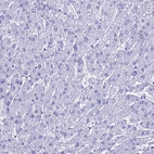 Immunohistochemical staining of human liver shows no positivity in hepatocytes as expected.