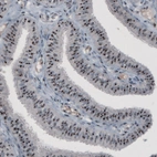 Immunohistochemical staining of human fallopian tube shows strong nucleolar immunoreactivity in glandular and connective tissue cells.