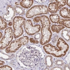 Immunohistochemical staining of human kidney shows strong cytoplasmic granular positivity in cells in tubules.