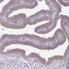 Immunohistochemical staining of human fallopian tube shows moderate positivity in cilia in glandular cells.