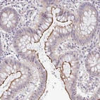 Immunohistochemical staining of human colon shows strong positivity in apical membrane in glandular cells.