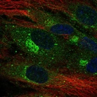 Immunofluorescent staining of human cell line HUVEC TERT2 shows localization to endoplasmic reticulum & the Golgi apparatus.
