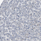 Immunohistochemical staining of human liver shows no nuclear positivity in hepatocytes as expected.