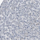 Immunohistochemical staining of human liver shows no nuclear positivity in hepatocytes as expected.