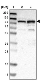 Lane 1: Marker [kDa] 230, 130, 95, 72, 56, 36, 28, 17, 11_br/_Lane 2: Human cell line RT-4_br/_Lane 3: Human cell line U-251MG sp