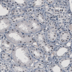 Anti-NOP56 Antibody