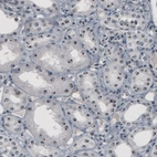 Immunohistochemical staining of human kidney shows strong nucleolar positivity in renal tubules.