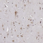 Immunohistochemical staining of human cerebral cortex shows strong cytoplasmic positivity in neurons.