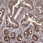 Immunohistochemical staining of human small intestine shows strong cytoplasmic and cytoplasmic granular positivity in glandular cells.