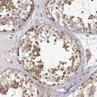 Immunohistochemical staining of human testis shows strong cytoplasmic positivity in cells in seminiferous ducts.