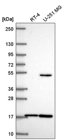 Western blot analysis in human cell line RT-4 and human cell line U-251 MG.