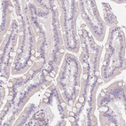 Immunohistochemical staining of human duodenum shows no positivity in glandular cells as expected.