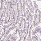 Immunohistochemical staining of human duodenum shows no positivity in glandular cells as expected.