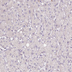 Immunohistochemical staining of human liver shows no positivity in hepatocytes as expected.