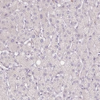Immunohistochemical staining of human liver shows no positivity in hepatocytes as expected.