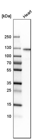 Western blot analysis in human heart tissue.